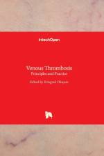 Venous Thrombosis