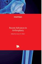 Recent Advances in Arthroplasty af SAMO FOKTER