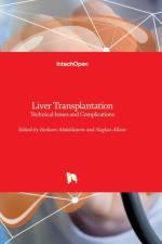 Liver Transplantation af NAGLAA ALLAM