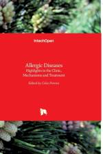 Allergic Diseases af Celso Pereira
