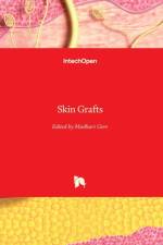 Skin Grafts