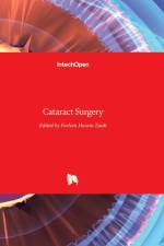 Cataract Surgery af FARHAN ZAIDI