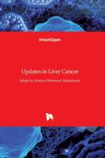 Updates in Liver Cancer