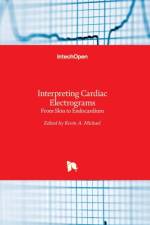 Interpreting Cardiac Electrograms