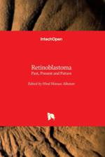 Retinoblastoma