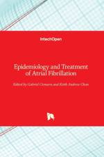 Epidemiology and Treatment of Atrial Fibrillation