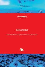 Melanoma