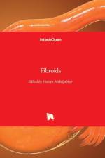 Fibroids