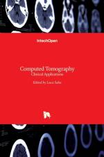 Computed Tomography af Luca Saba