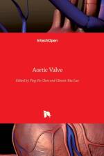 Aortic Valve af CHEN YING-FU