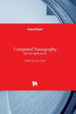Computed Tomography af Luca Saba