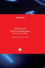 Advances in Electrocardiograms af RICHARD MILLIS