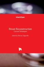 Breast Reconstruction af MARZIA SALGARELLO