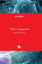 Tumor Angiogenesis af SOPHIA RAN