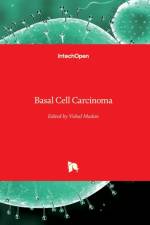 Basal Cell Carcinoma af Vishal Madan