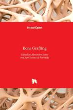 Bone Grafting af ALESSANDRO RO ZORZI