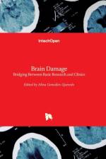 Brain Damage af AL GONZALEZ-QUEVEDO