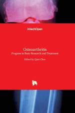 Osteoarthritis af QIAN CHEN