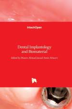 Dental Implantology and Biomaterial af MAZEN AHMAD ALMASRI