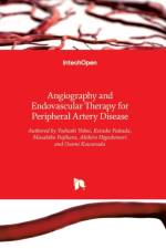 Angiography and Endovascular Therapy for Peripheral Artery Disease af Yoshiaki Yokoi
