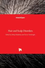 Hair and Scalp Disorders af ZEKAYI KUTLUBAY
