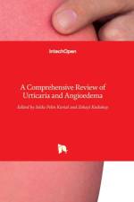 Urticaria and Angioedema af SELDA PELIN KARTAL