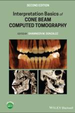 Interpretation Basics of Cone Beam Computed Tomography af SM Gonzalez