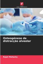 Osteogenese de distraccao alveolar af Rajat Mohanty