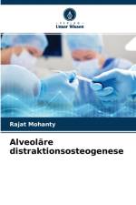 Alveolare distraktionsosteogenese af Rajat Mohanty