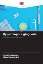 Hypertrophie gingivale af Shivalingesh Kk