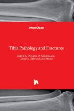 Tibia Pathology and Fractures