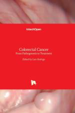 Colorectal Cancer af Luis Rodrigo