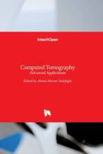 Computed Tomography af AHMET ME HALEFOGLU