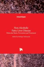 Non-Alcoholic Fatty Liver Disease af ROD VALENZUELA BAEZ