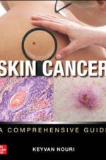Skin Cancer: A Comprehensive Guide af Keyvan Nouri