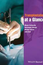 Transplantation at a Glance af Menna (University of Cambridge Clatworthy