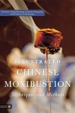 Illustrated Chinese Moxibustion Techniques and Methods af Xiaorong Chang