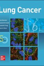 Lung Cancer:  Standards of Care af Goetz Kloecker