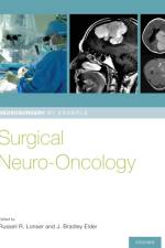 Surgical Neuro-Oncology