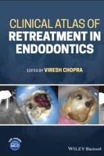 Clinical Atlas of Retreatment in Endodontics af V Chopra