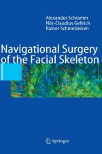 Navigational Surgery of the Facial Skeleton af Alexander Schramm