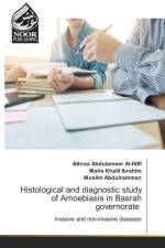 Histological and diagnostic study of Amoebiasis in Basrah governorate af Athraa Abdulameer Al-Hilfi