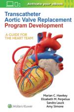 Transcatheter Aortic Valve Replacement Program Development af Marian C Hawkey