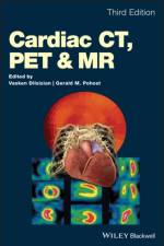 Cardiac CT, PET and MR af V Dilsizian