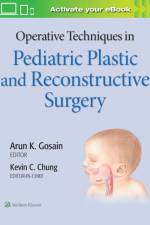 Operative Techniques in Pediatric Plastic and Reconstructive Surgery