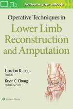 Operative Techniques in Lower Limb  Reconstruction and Amputation