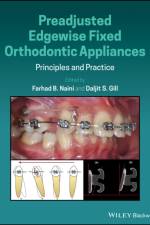 Preadjusted Edgewise Fixed Orthodontic Appliances af FB Naini