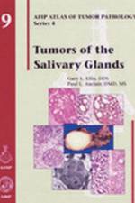 Tumors of the Salivary Glands af Gary L. Ellis