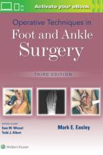 Operative Techniques in Foot and Ankle Surgery