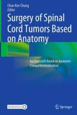 Surgery of Spinal Cord Tumors Based on Anatomy